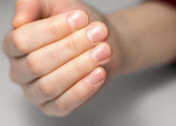 Tırnak Kırılmasına Hangi Vitamin İyi Gelir?